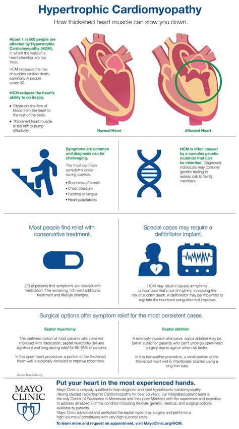 Infographic: Hypertrophic Cardiomyopathy – Mayo Clinic News Network | Hypertrophic ...