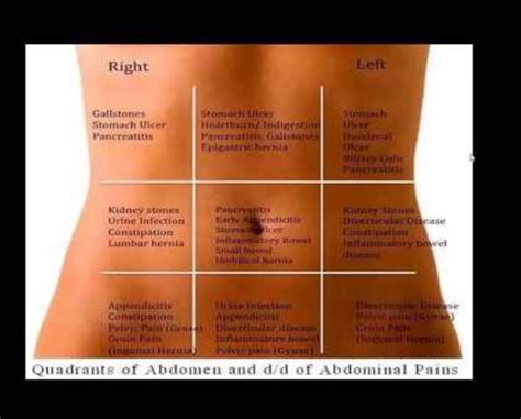 Abdominal Pain Chart And Symptoms