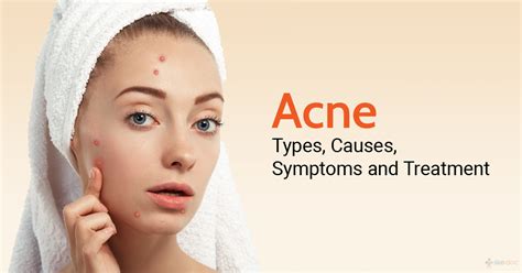 Acne: Causes, Symptoms, Prevention and Treatment