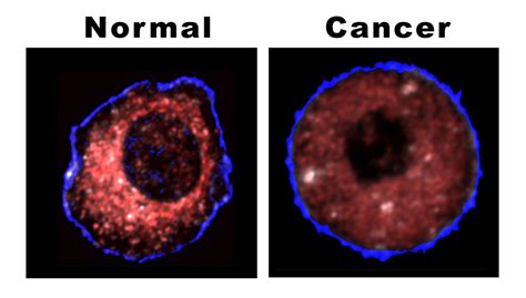 Novel ultrafast laser detects cancer at earliest possible stage