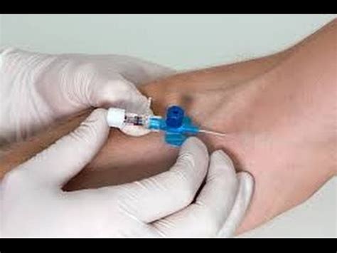 IV Cannulation Technique - YouTube