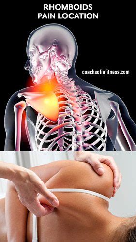 Fast Rhomboid Muscle Pain Relief: Exercises & Stretches - Coach Sofia Fitness