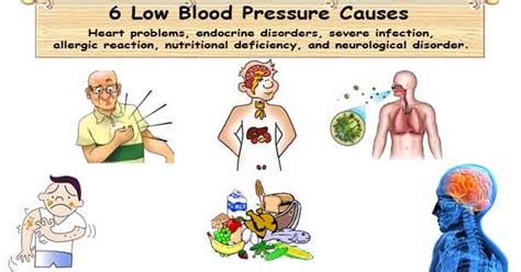 Low Blood Pressure Cause | 6 Cause of Hypotension Low BP