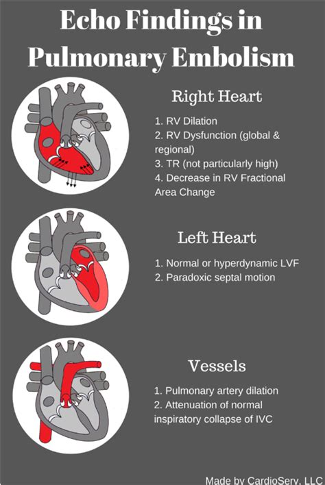 Echocardiography in Pulmonary Embolism...the Clot Thickens Cardioserv