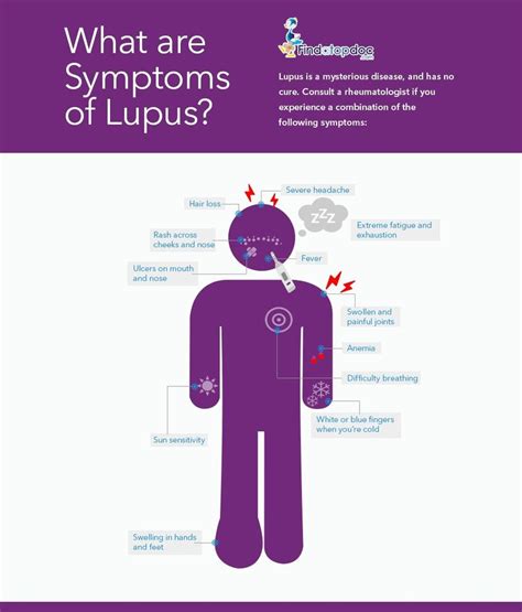 What to Ask After a Lupus Diagnosis