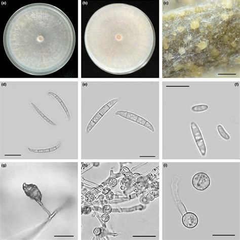 Fusarium Oxysporum Conidia