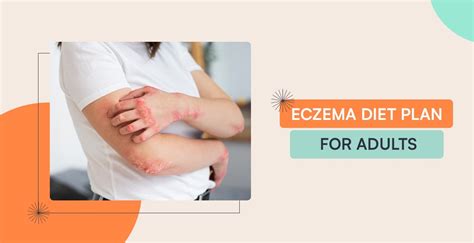 Eczema Diet Plan For Adults: Nourish An Heal Your Skin In 7 Days