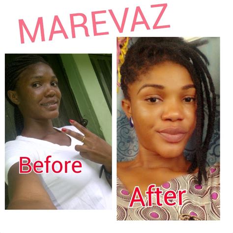 Real Whitening Skin: Learn The best skin lightening cream in nigeria