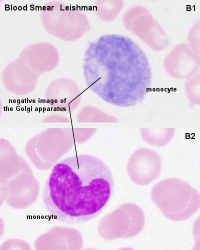 Monocyte on a smear | Medical Laboratories