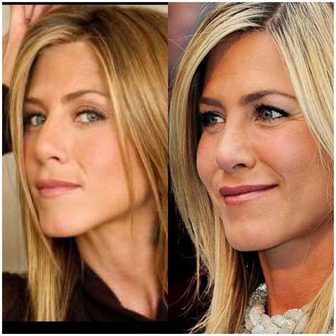 jennifer aniston: before and after - Claudia and the Gossip