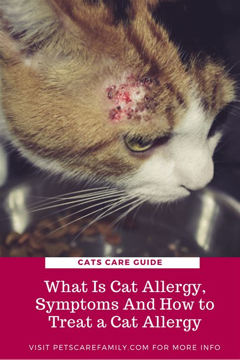 What Is Cat Allergy, Symptoms And How to Treat a Cat Allergy | Cat ...