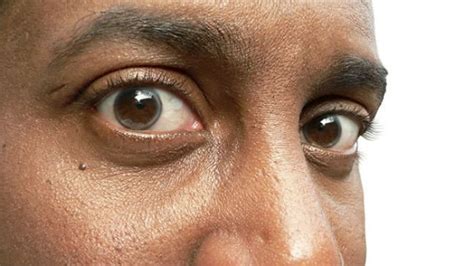 Man found dead with eye removed – Nehanda Radio