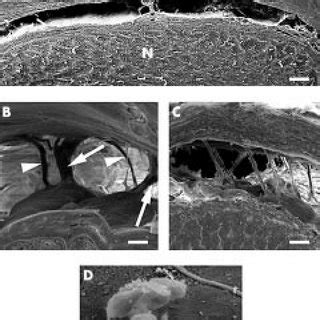 TEM morphology of arachnoid trabeculae in the bulbar segment. The... | Download Scientific Diagram