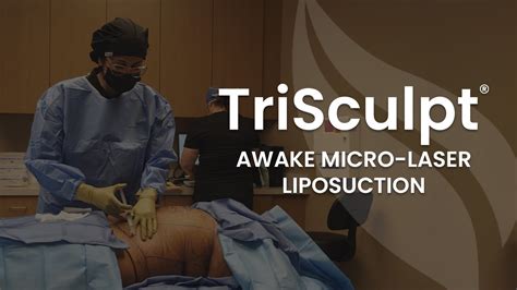 Awake Micro-Laser Liposuction Procedure | Live TriSculpt Fat Removal ...