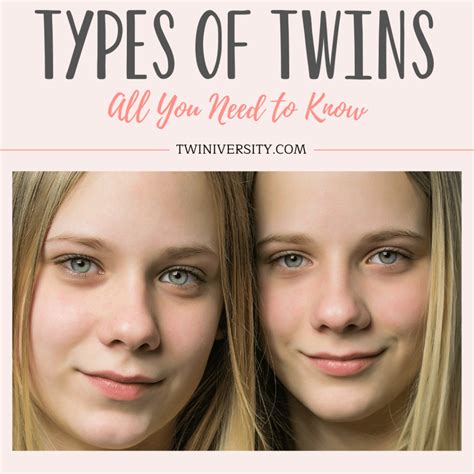 Types Of Twins That Are Extremely Rare, 55% OFF