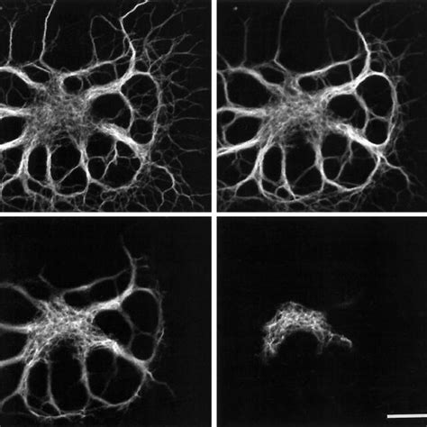 Electron micrograph of "hooked" microtubules in oligodendrocyte... | Download Scientific Diagram