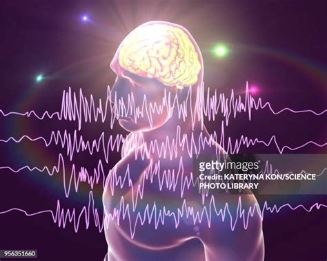 163 Epilepsy Brain Waves Stock Photos, High-Res Pictures, and Images - Getty Images