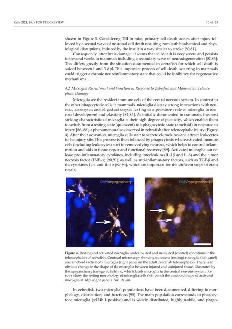 Resting and activated microglia under injured and uninjured (control)... | Download Scientific ...