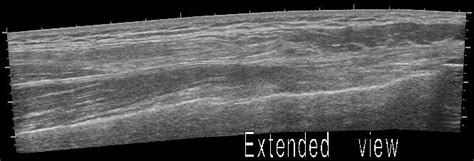 Musculoskeletal Ultrasound