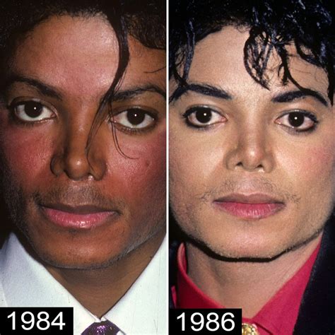 Michael Jackson's Plastic Surgery — See His Transformation