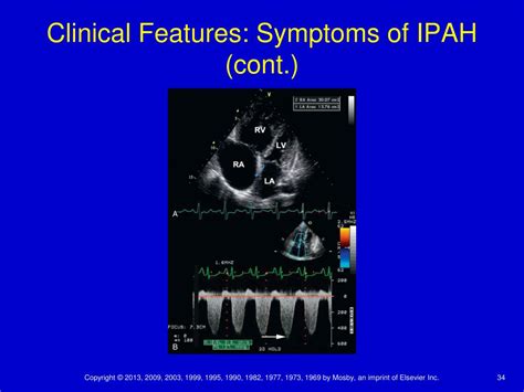 PPT - Chapter 26 Pulmonary Vascular Disease PowerPoint Presentation, free download - ID:3477089