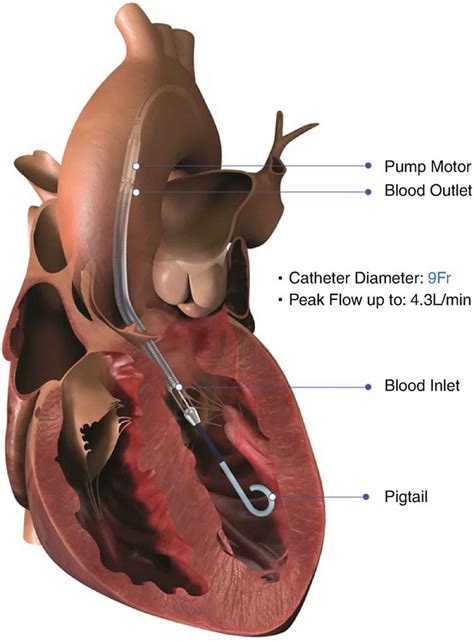 Impella ventricular assist device