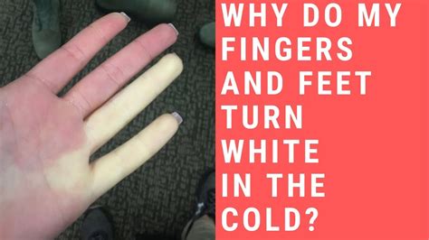 List Of Why Do My Fingernails Turn White Ideas - fsabd42