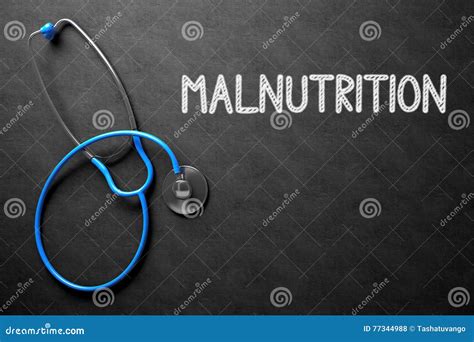 Malnutrition Stock Illustrations – 1,417 Malnutrition Stock Illustrations, Vectors & Clipart ...