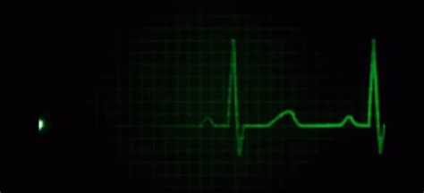 Flatline Heartbeat GIF - Flatline Flat Heartbeat - Gif's ontdekken en delen