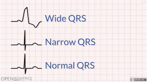 Cara Membaca EKG Dengan Benar dan Cepat From A to Z | INA - ECG