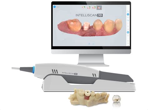 Intraoral Scanner Designed for Easy Use - Dentistry Today