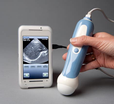 See Through You: Handheld Ultrasound is Ultra-Portable | Gadgets, Science & Technology