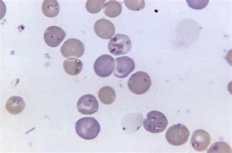 Free picture: blood, cells, babesia, microti, plasmodium berghei, mag, 1125x