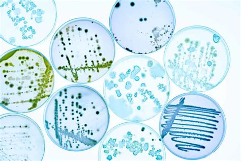 What is an Endospore Stain? – Microscope Clarity