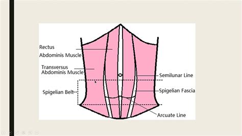 Types Of Hernia Diagram