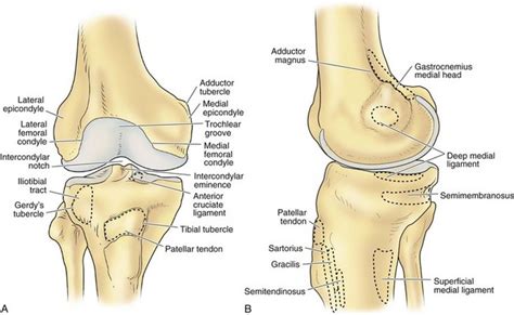 Lateral Condyle Femur