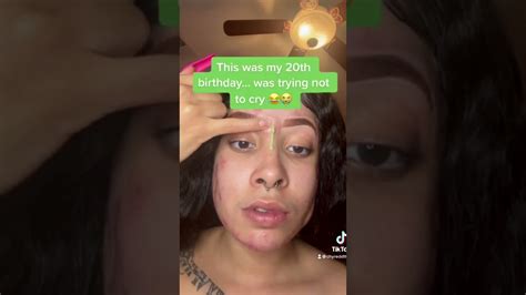 Cystic acne popping 2022 - loan nguyen newest cyst popping videos - YouTube