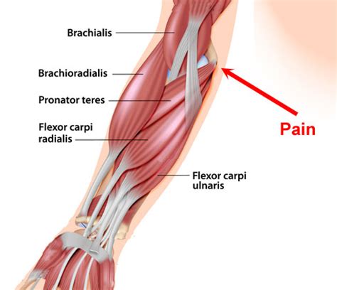 Golfer's Elbow | Symptoms, Causes and Treatment