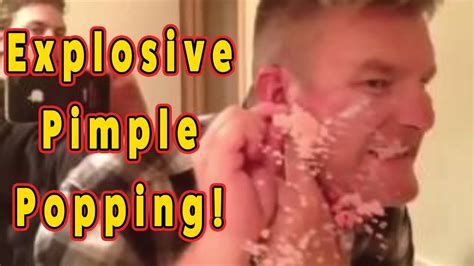 zits on the face Archives - Pimple Popping Videos