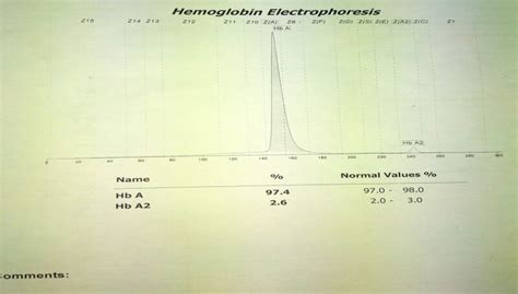 [Figure, Normal Hemoglobin electrophoresis Contributed by Anam Khan MD ...