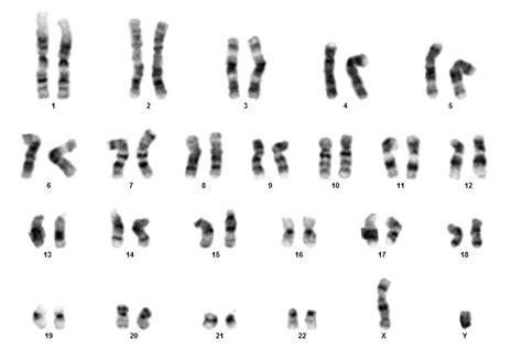 Karyotype service for human cells