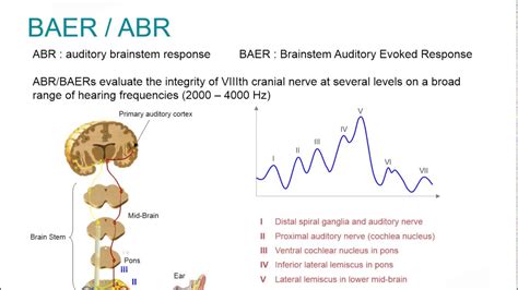 Natus EP Webinar: Clinical Auditory Evoked Potentials - YouTube