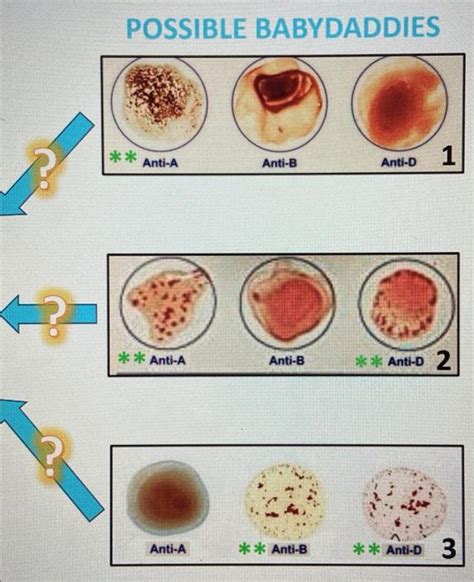 Solved Blood Typing: In this game you have to blood type | Chegg.com