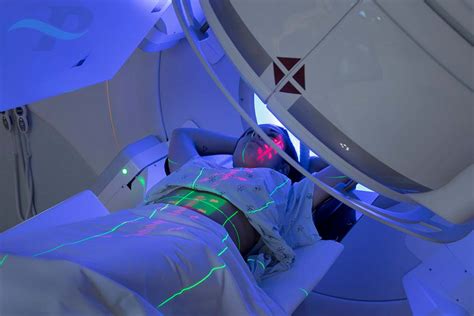 External Beam Radiation Therapy | Premier Radiation Oncology Associates