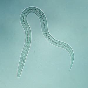 CDC - DPDx - Intestinal Hookworm