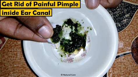 Get Rid of Painful Pimple inside Ear Canal | Education and Information Technology | Information ...