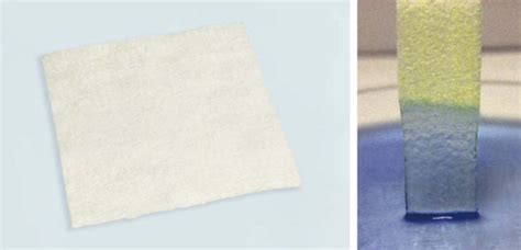 Chitosan wound dressing - Agna Healthcare