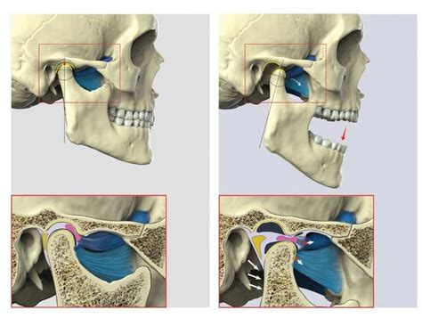 Lateral Pterygoid muscle - Origin, Insertion, Function, Exercise