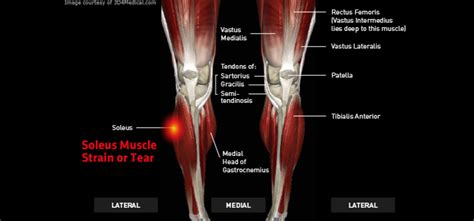 Soleus Muscle Strain or Tear – Knee Braces & Ankle Supports | Sports & Injury Braces | Thermoskin