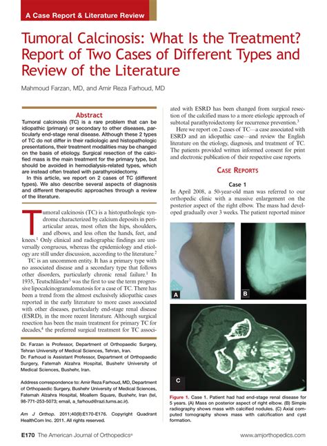 (PDF) Tumoral calcinosis: what is the treatment? Report of two cases of ...